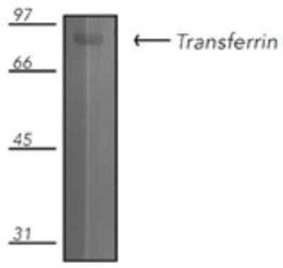 Western Blot: Transferrin Antibody [NBP1-97472]