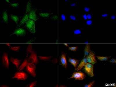 Immunocytochemistry/ Immunofluorescence: TfR (Transferrin R) Antibody - BSA Free [NB100-92243]