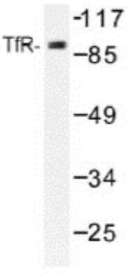 Western Blot: TfR (Transferrin R) AntibodyBSA Free [NB100-92243]