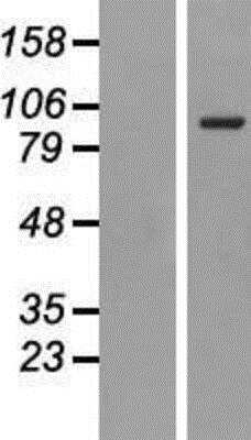 Western Blot: TfR (Transferrin R) Overexpression Lysate [NBP2-08027]