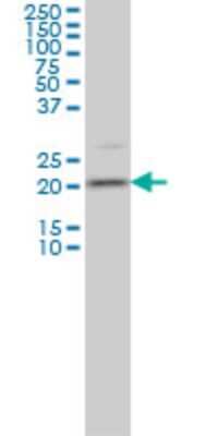 Western Blot: Transgelin-3 Antibody (1D2) [H00029114-M01]