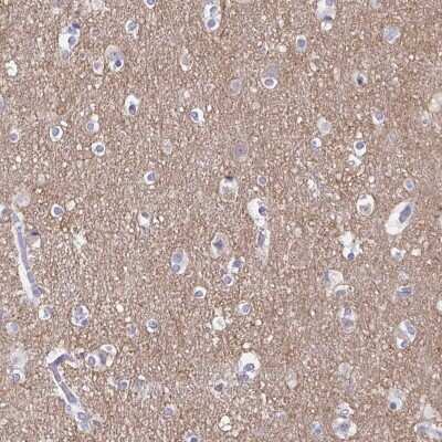 Immunohistochemistry-Paraffin: Transgelin-3 Antibody [NBP2-37995]