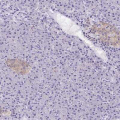 Immunohistochemistry-Paraffin: Transgelin-3 Antibody [NBP2-37995]