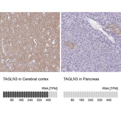 Immunohistochemistry-Paraffin: Transgelin-3 Antibody [NBP2-37995]