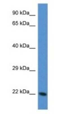 Western Blot: Transgelin-3 Antibody [NBP1-74167]