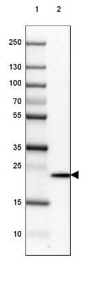 Western Blot: Transgelin-3 Antibody [NBP2-37995]