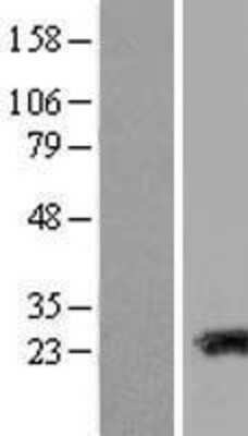 Western Blot: Transgelin-3 Overexpression Lysate [NBL1-16694]