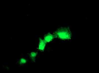 Immunocytochemistry/ Immunofluorescence: Transgelin/TAGLN/SM22 alpha Antibody (OTI8C8) [NBP2-00894]