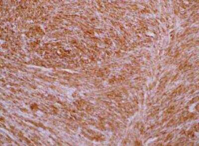 Immunohistochemistry-Paraffin: Transgelin/TAGLN/SM22 alpha Antibody (OTI8C8) [NBP2-00894]