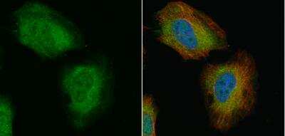 Immunocytochemistry/ Immunofluorescence: Transgelin/TAGLN/SM22 alpha Antibody [NBP1-33003]