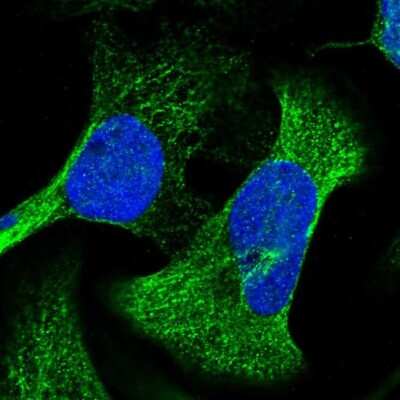 Immunocytochemistry/ Immunofluorescence: Transgelin/TAGLN/SM22 alpha Antibody [NBP1-87981]