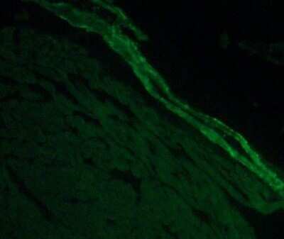 Immunohistochemistry: Transgelin/TAGLN/SM22 alpha Antibody [NBP2-20405]