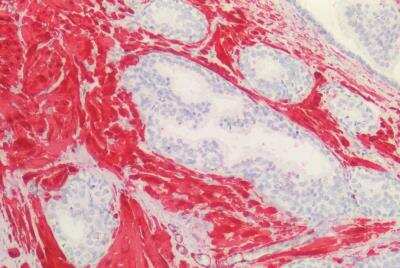 Immunohistochemistry-Paraffin: Transgelin/TAGLN/SM22 alpha Antibody [NB600-507]