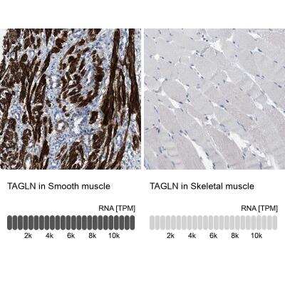 Immunohistochemistry-Paraffin: Transgelin/TAGLN/SM22 alpha Antibody [NBP1-87981]