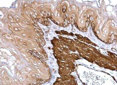 Immunohistochemistry-Paraffin: Transgelin/TAGLN/SM22 alpha Antibody [NBP2-20405]