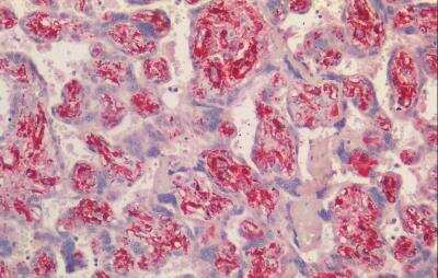 Immunohistochemistry-Paraffin: Transgelin/TAGLN/SM22 alpha Antibody [NBP3-12108]