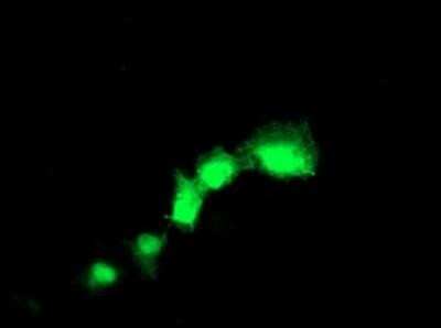 Immunocytochemistry/ Immunofluorescence: Transgelin/TAGLN/SM22 alpha Antibody (OTI8C8) - Azide and BSA Free [NBP2-74584]