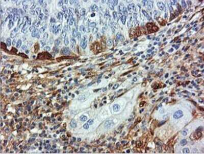 Immunohistochemistry: Transgelin/TAGLN/SM22 alpha Antibody (OTI8C8) - Azide and BSA Free [NBP2-74584]