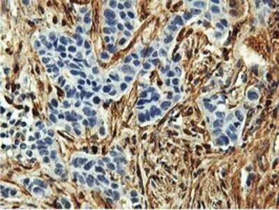 Immunohistochemistry: Transgelin/TAGLN/SM22 alpha Antibody (OTI8C8) - Azide and BSA Free [NBP2-74584]