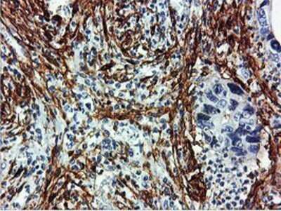 Immunohistochemistry: Transgelin/TAGLN/SM22 alpha Antibody (OTI8C8) - Azide and BSA Free [NBP2-74584]