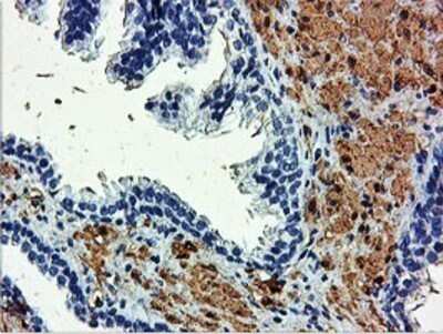 Immunohistochemistry: Transgelin/TAGLN/SM22 alpha Antibody (OTI8C8) - Azide and BSA Free [NBP2-74584]