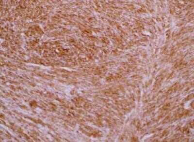 Immunohistochemistry: Transgelin/TAGLN/SM22 alpha Antibody (OTI8C8) - Azide and BSA Free [NBP2-74584]
