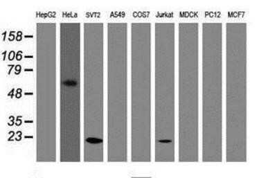 Western Blot: Transgelin/TAGLN/SM22 alpha Antibody (OTI8C8)Azide and BSA Free [NBP2-74584]