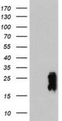 Western Blot: Transgelin/TAGLN/SM22 alpha Antibody (OTI8C8)Azide and BSA Free [NBP2-74584]