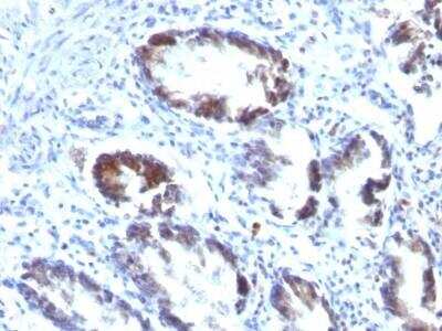 Immunohistochemistry-Paraffin: Transgelin/TAGLN/SM22 alpha Antibody (TAGLN/247) - Azide and BSA Free [NBP2-47688]
