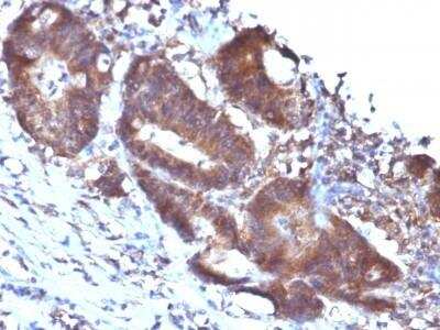 Immunohistochemistry-Paraffin: Transgelin/TAGLN/SM22 alpha Antibody (TAGLN/247) - Azide and BSA Free [NBP2-47688]