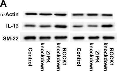 Western Blot: Transgelin/TAGLN/SM22 alpha Antibody [NB600-507]