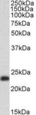 Western Blot: Transgelin/TAGLN/SM22 alpha Antibody [NB600-507]