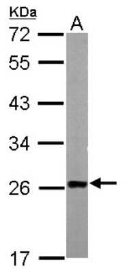 Western Blot: Transgelin/TAGLN/SM22 alpha Antibody [NBP2-20405]