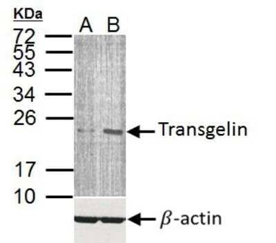 Western Blot: Transgelin/TAGLN/SM22 alpha Antibody [NBP2-20405]