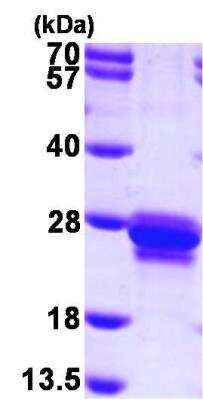 SDS-PAGE: Recombinant Human Transgelin/TAGLN/SM22 alpha His Protein [NBP1-45267]