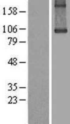 Western Blot: Transglutaminase 1/TGM1 Overexpression Lysate [NBL1-16865]