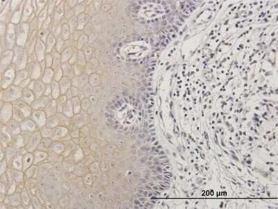 Immunohistochemistry-Paraffin: Transglutaminase 1/TGM1 Antibody [H00007051-B02P]