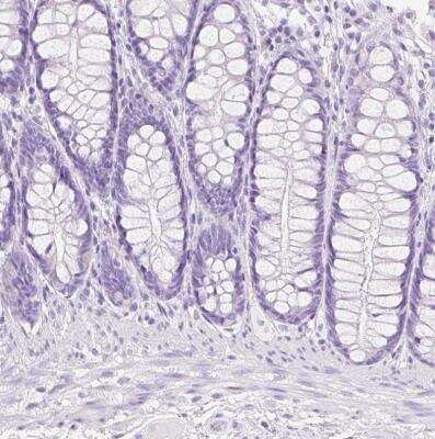 Immunohistochemistry-Paraffin: Transglutaminase 1/TGM1 Antibody [NBP2-34062]
