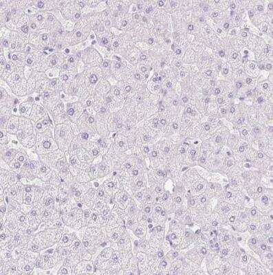 Immunohistochemistry-Paraffin: Transglutaminase 1/TGM1 Antibody [NBP2-34062]
