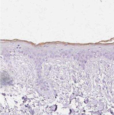 Immunohistochemistry-Paraffin: Transglutaminase 1/TGM1 Antibody [NBP2-34062]