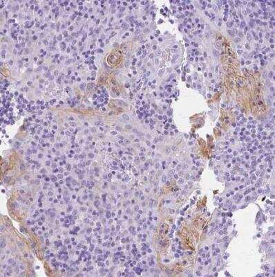 Immunohistochemistry-Paraffin: Transglutaminase 1/TGM1 Antibody [NBP2-34062]