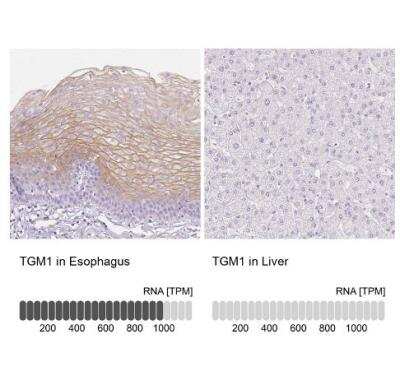 Immunohistochemistry-Paraffin: Transglutaminase 1/TGM1 Antibody [NBP2-34062]