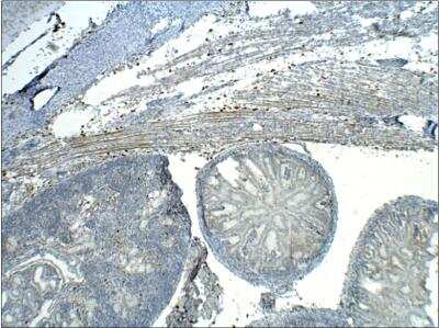 Immunohistochemistry-Paraffin: Transglutaminase 1/TGM1 Antibody [NBP3-12268]