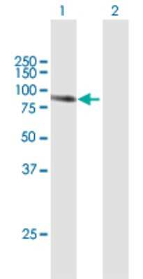 Western Blot: Transglutaminase 1/TGM1 Antibody [H00007051-B01P]