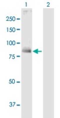 Western Blot: Transglutaminase 1/TGM1 Antibody [H00007051-B02P]