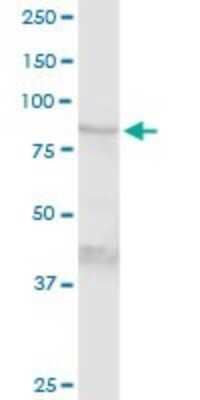 Western Blot: Transglutaminase 1/TGM1 Antibody [H00007051-D01P]