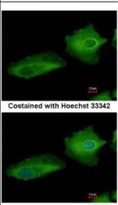 Immunocytochemistry/ Immunofluorescence: Transglutaminase 2/TGM2 Antibody [NBP2-20698]