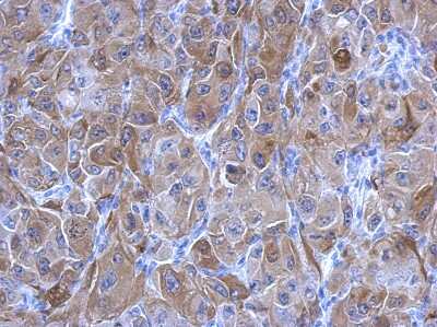 Immunohistochemistry-Paraffin: Transglutaminase 2/TGM2 Antibody [NBP2-20698]