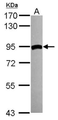 Western Blot: Transglutaminase 2/TGM2 Antibody [NBP2-20698]