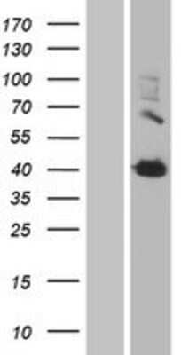 Western Blot: Transglutaminase 2/TGM2 Overexpression Lysate [NBL1-16866]